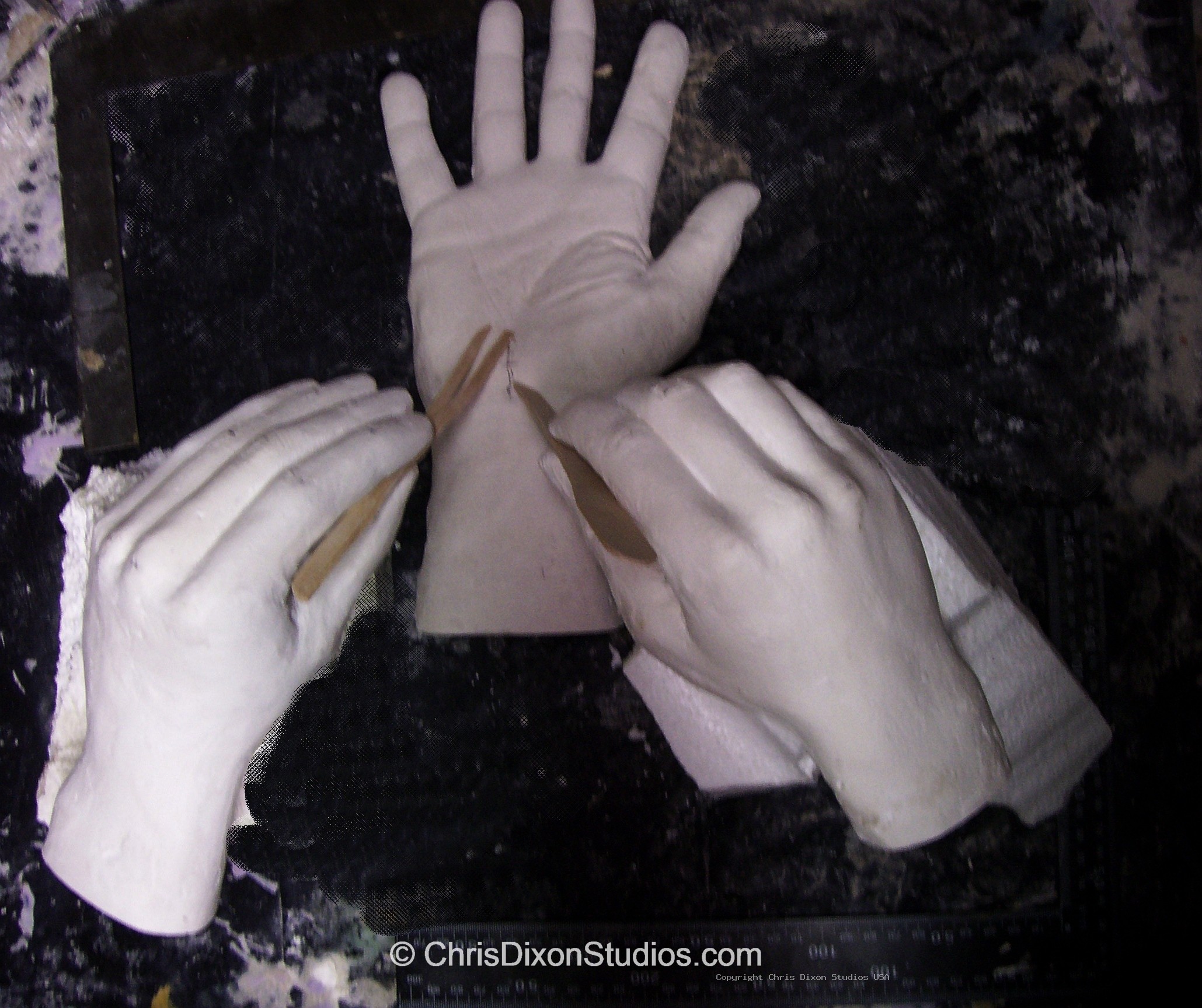 Carpal Tunnel Cast 08