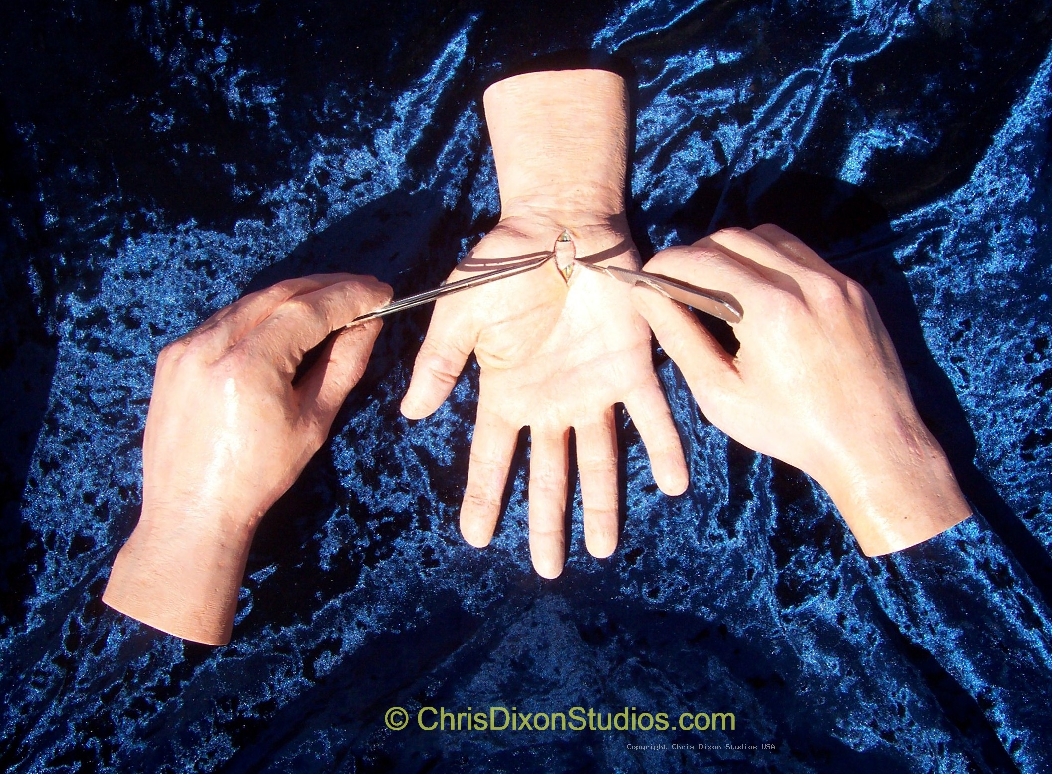 Carpal Tunnel Medical Model 35