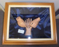 Carpal Tunne Medical Sculpture