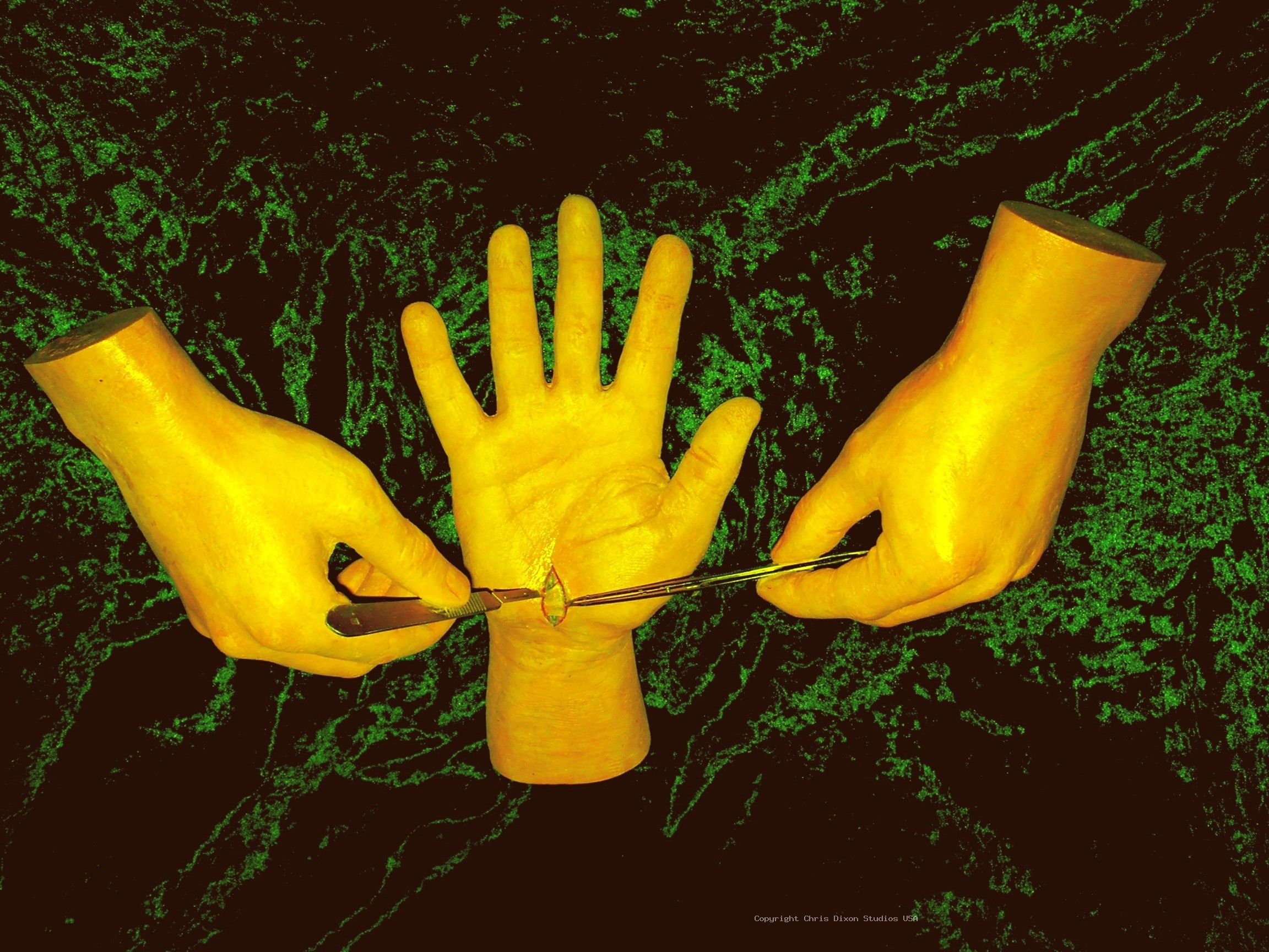Carpeltunnel2